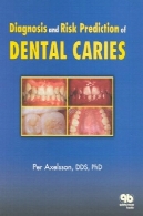 تشخیص و پیش بینی پوسیدگی جلد 2Diagnosis and Risk Prediction of Dental Caries, Volume 2