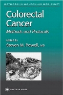 سرطان روده بزرگ: روش ها و پروتکل ها (روش در پزشکی مولکولی)Colorectal Cancer: Methods and Protocols (Methods in Molecular Medicine)