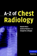 الف رادیولوژی قفسه سینهA-Z of Chest Radiology